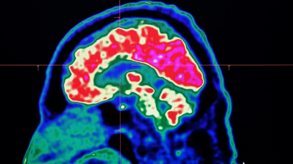 Final report casts doubt on existence of Canada mystery brain illness