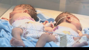 Una maternidad lucha por salvar vidas bajo las bombas en Sud&aacute;n