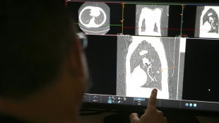 Un comprimido reduce a la mitad del riesgo de muerte de un tipo de c&aacute;ncer de pulm&oacute;n