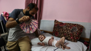 La sarna y los piojos se propagan entre los ni&ntilde;os de Gaza
