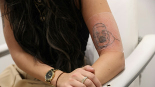 Estudio brit&aacute;nico ayuda a exfans de Kanye West a quitarse sus tatuajes